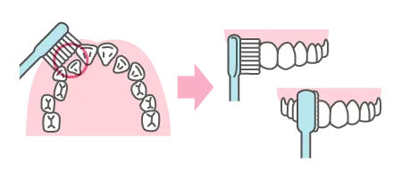 歯磨きの工夫５図解