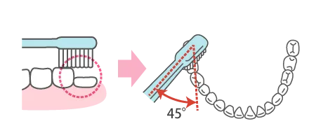 歯磨きの工夫６図解