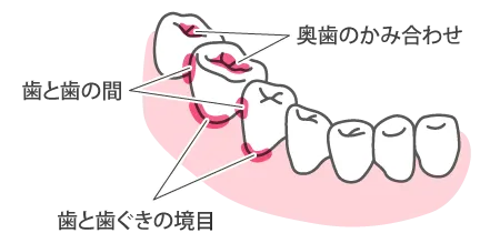 歯磨きのポイント１